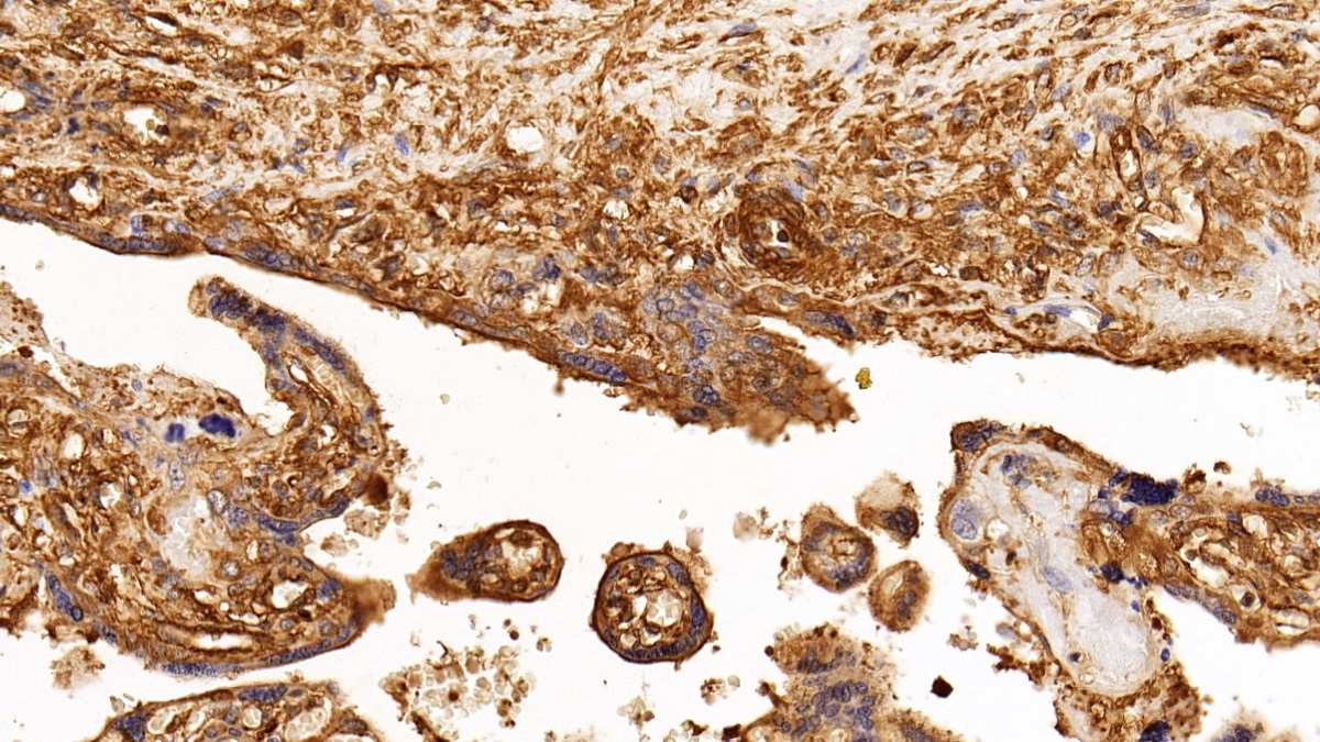 Monoclonal Antibody to Insulin Receptor (INSR)