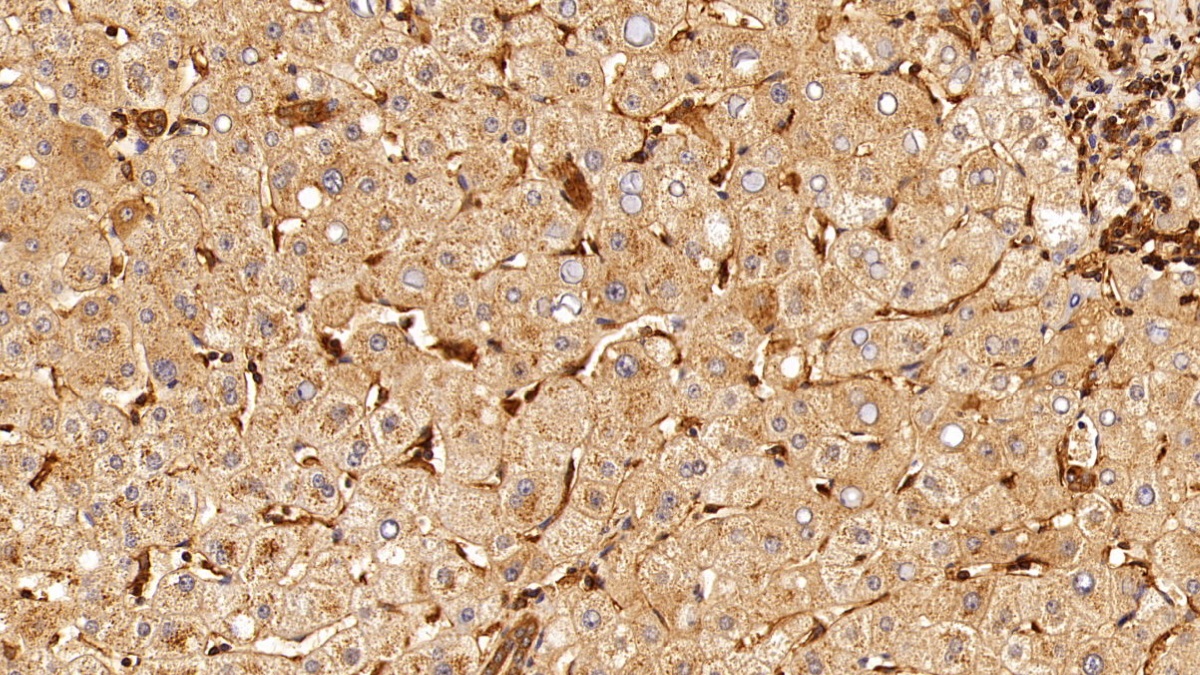 Monoclonal Antibody to Insulin Receptor (INSR)