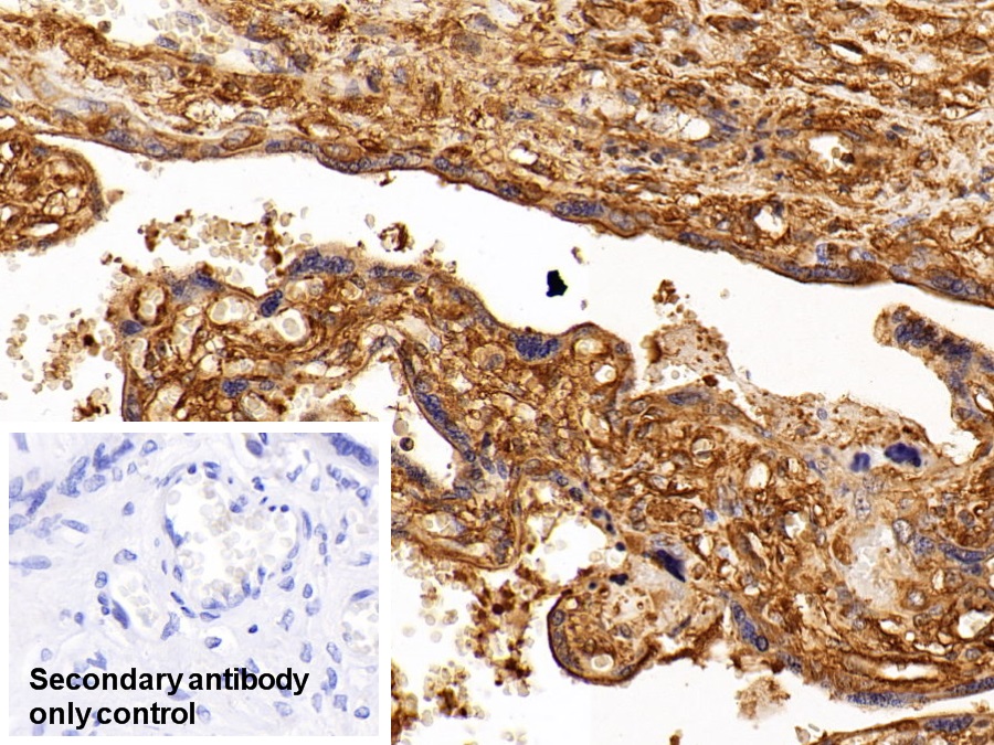 Monoclonal Antibody to Insulin Receptor (INSR)