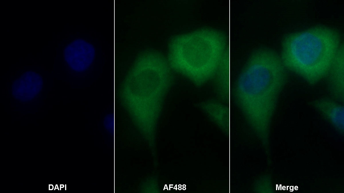 Monoclonal Antibody to Insulin Receptor (INSR)