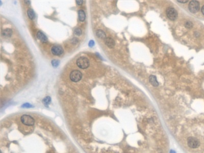 Monoclonal Antibody to Cystatin C (Cys-C)