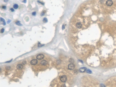 Monoclonal Antibody to Cystatin C (Cys-C)