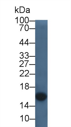 Monoclonal Antibody to Cystatin C (Cys-C)