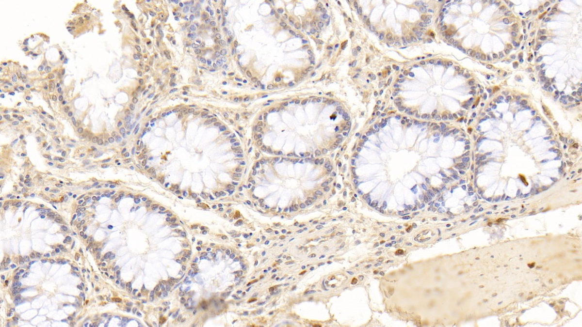 Monoclonal Antibody to Osteopontin (OPN)