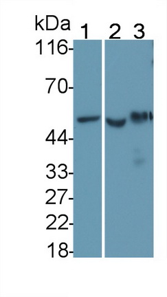 Monoclonal Antibody to Tumor Protein p53 (P53)