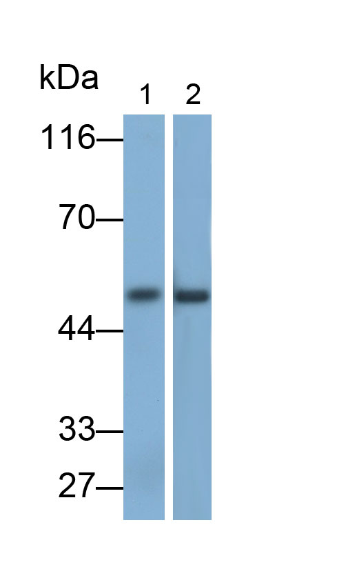 Monoclonal Antibody to Tumor Protein p53 (P53)