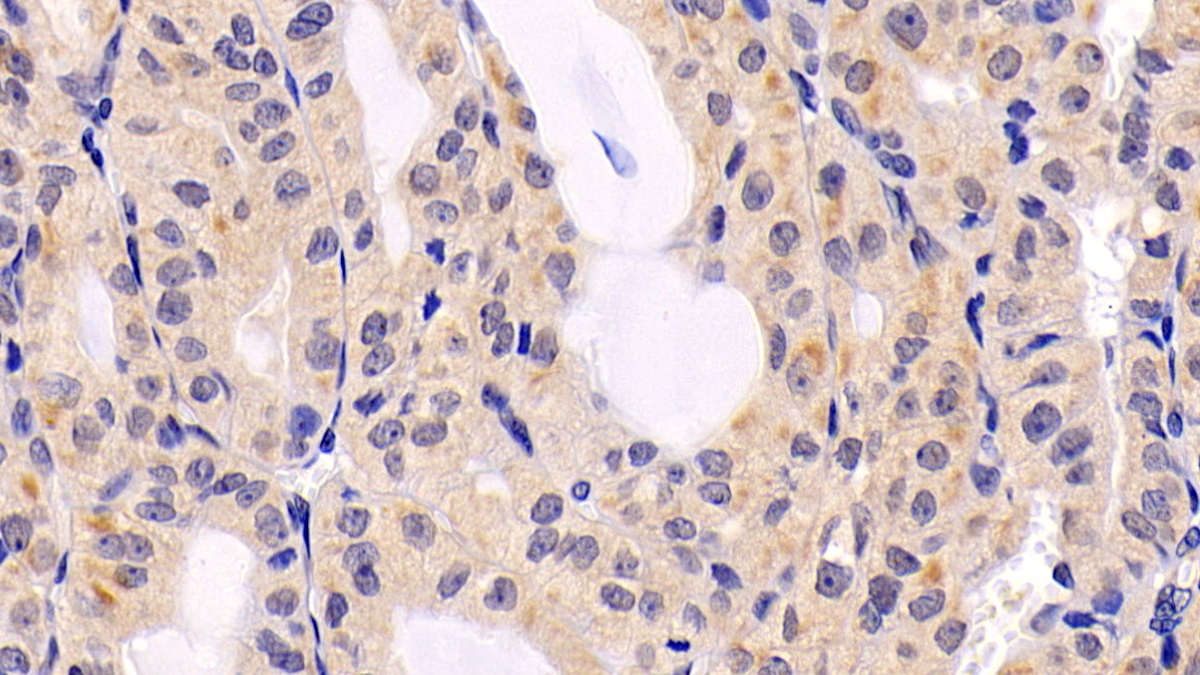 Monoclonal Antibody to Extracellular Signal Regulated Kinase 2 (ERK2)