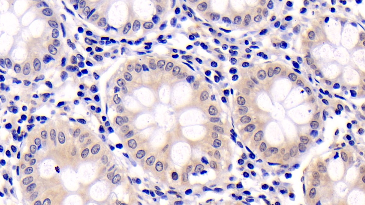 Monoclonal Antibody to Extracellular Signal Regulated Kinase 2 (ERK2)