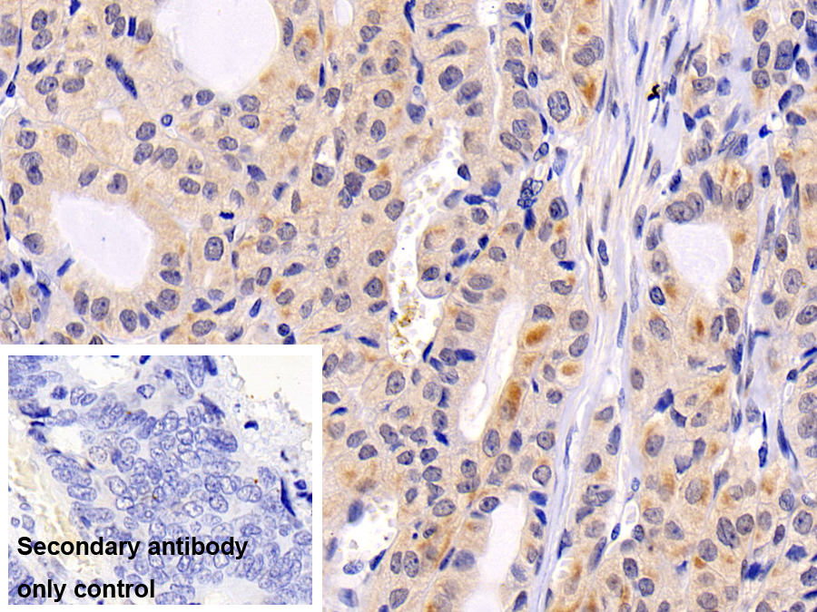 Monoclonal Antibody to Extracellular Signal Regulated Kinase 2 (ERK2)