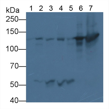 Monoclonal Antibody to Nephrin (NPHN)