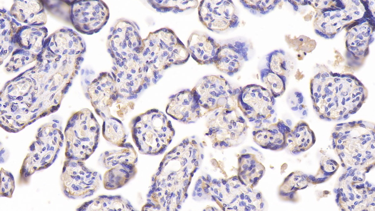 Monoclonal Antibody to Chemerin (CHEM)