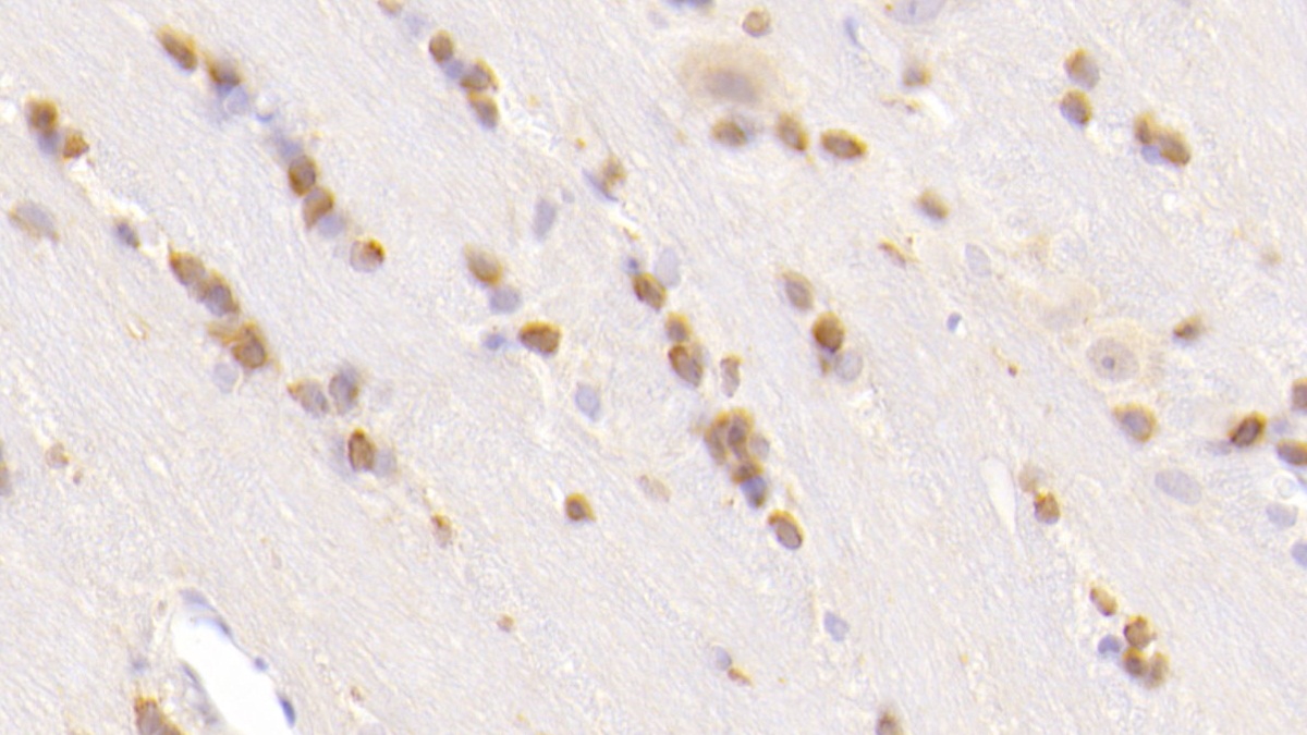 Monoclonal Antibody to Chemerin (CHEM)