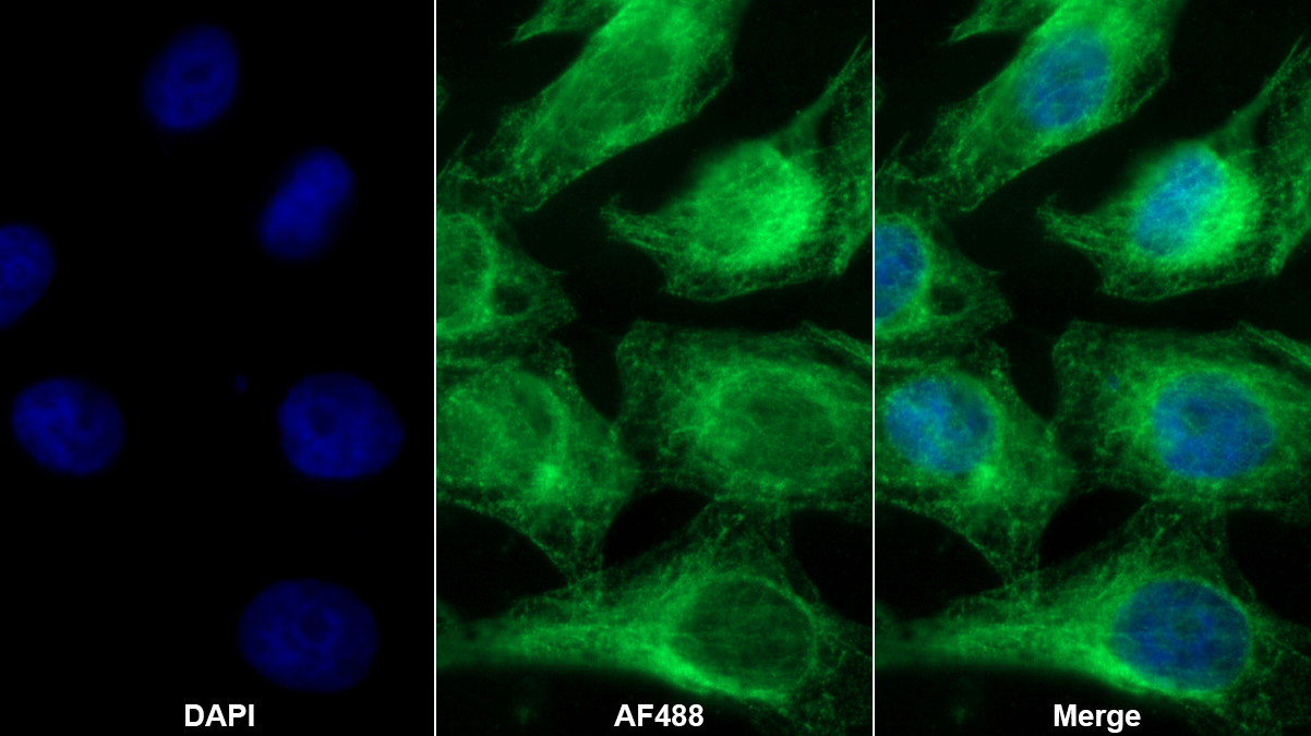 Monoclonal Antibody to Procollagen I N-Terminal Propeptide (PINP)