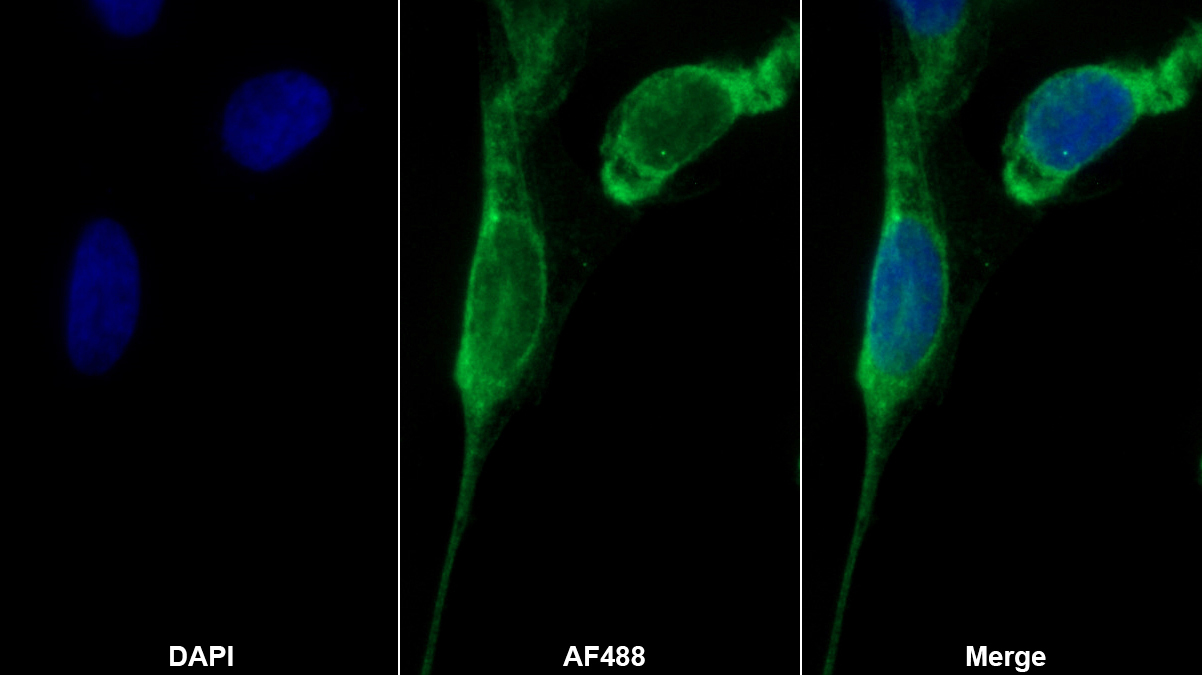Monoclonal Antibody to Procollagen I N-Terminal Propeptide (PINP)