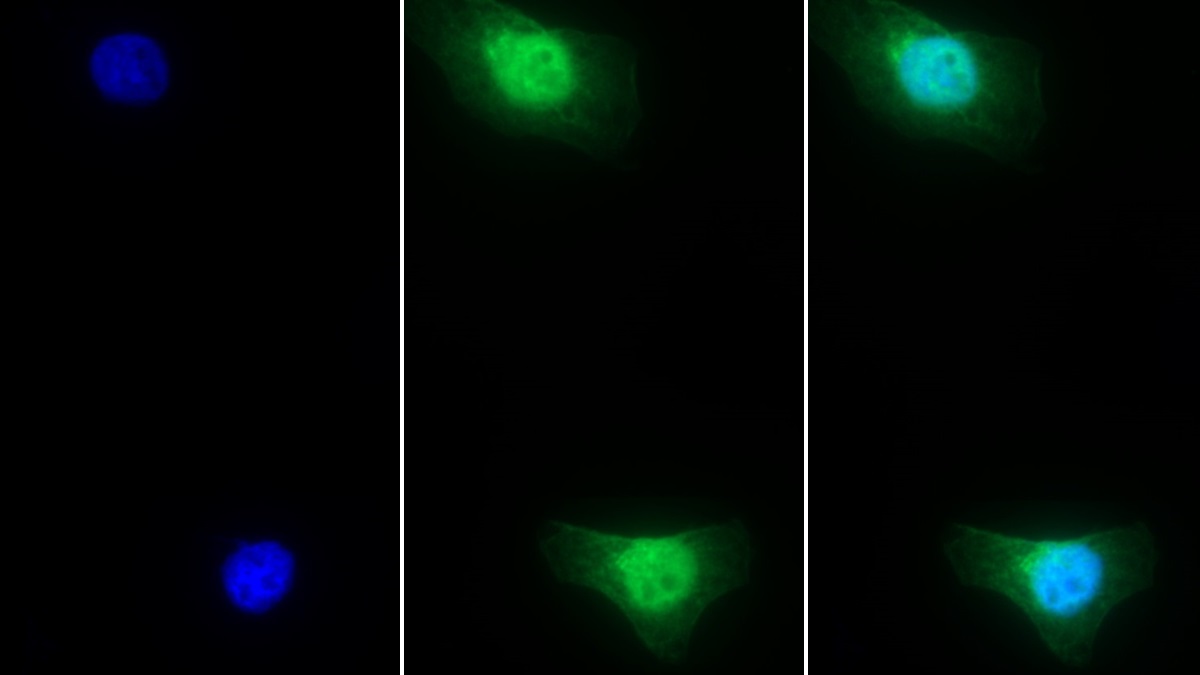 Monoclonal Antibody to Cyclophilin A (CYPA)