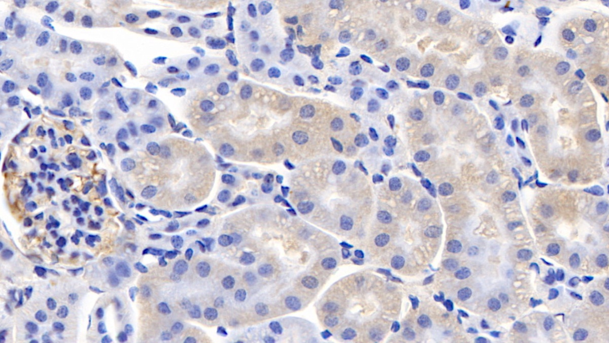 Monoclonal Antibody to Cyclophilin A (CYPA)