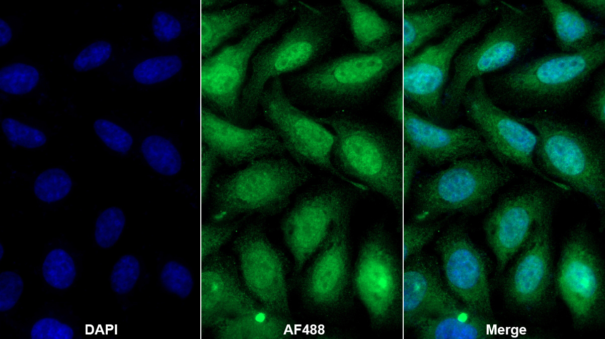 Monoclonal Antibody to Cyclophilin A (CYPA)