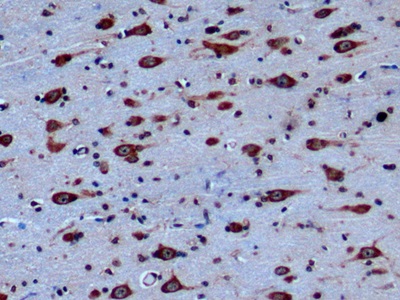 Monoclonal Antibody to Endoglin (ENG)