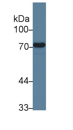 Monoclonal Antibody to Endoglin (ENG)