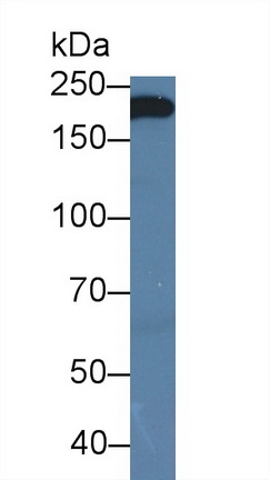 Monoclonal Antibody to Alpha-2-Macroglobulin (a2M)