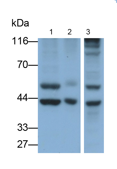 Monoclonal Antibody to Angiopoietin Like Protein 4 (ANGPTL4)