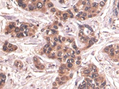 Monoclonal Antibody to Beta Catenin (β-catenin)