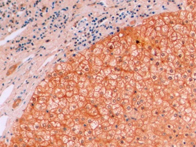 Monoclonal Antibody to Beta Catenin (β-catenin)