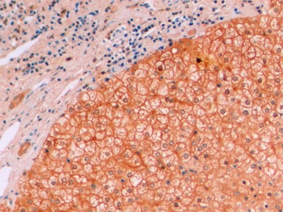 Monoclonal Antibody to Beta Catenin (β-catenin)