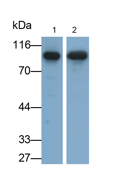 Monoclonal Antibody to Beta Catenin (β-catenin)