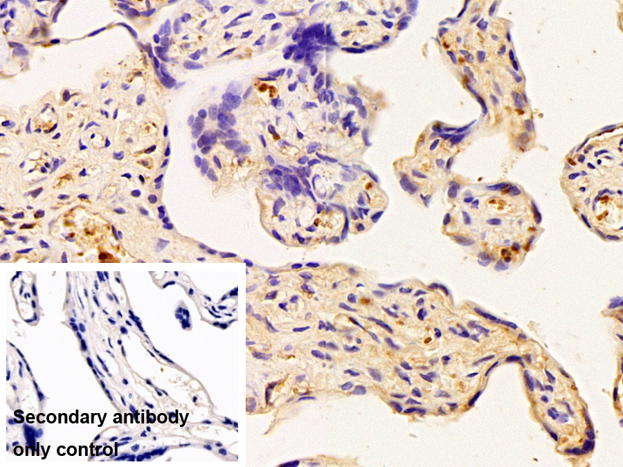 Monoclonal Antibody to Albumin (ALB)