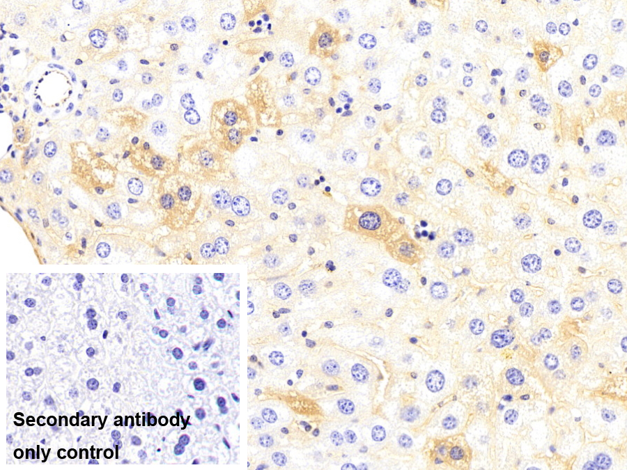 Monoclonal Antibody to Albumin (ALB)
