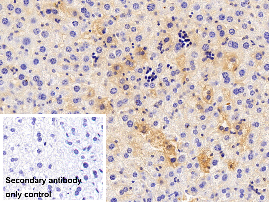 Monoclonal Antibody to Albumin (ALB)