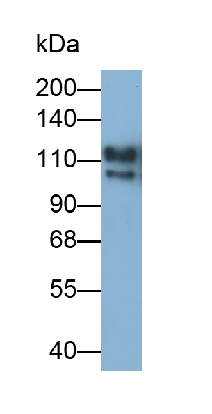 Monoclonal Antibody to Integrin Alpha 2B (ITGa2B)