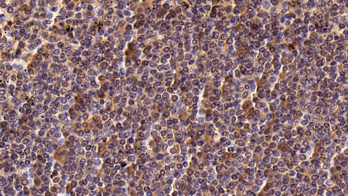 Monoclonal Antibody to Protein Tyrosine Phosphatase Receptor Type C (CD45)