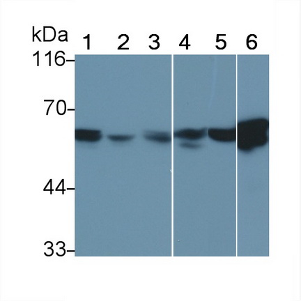 Monoclonal Antibody to Vimentin (VIM)