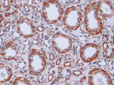 Monoclonal Antibody to Vimentin (VIM)