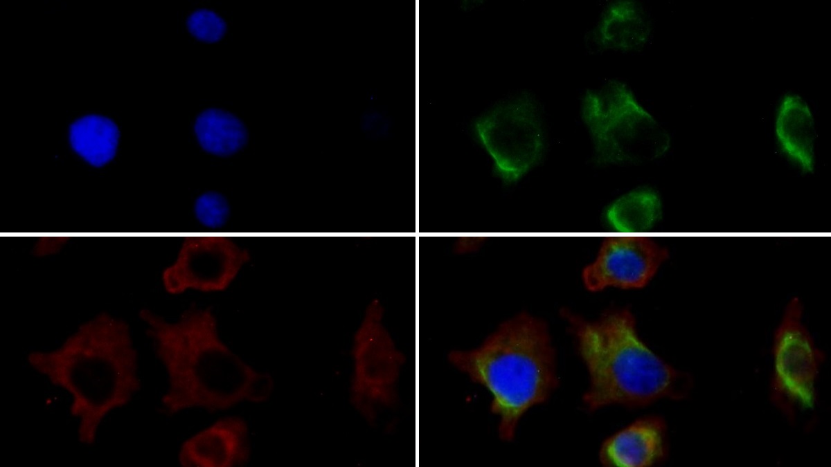 Monoclonal Antibody to Vimentin (VIM)