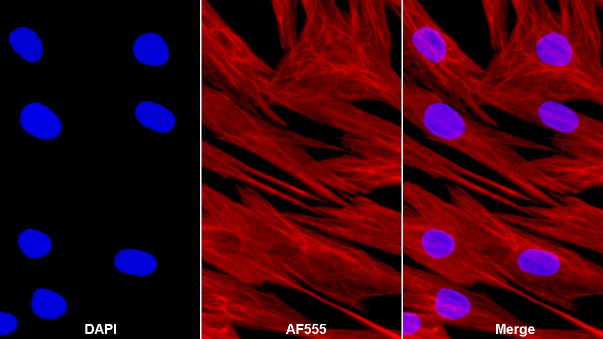 Monoclonal Antibody to Vimentin (VIM)