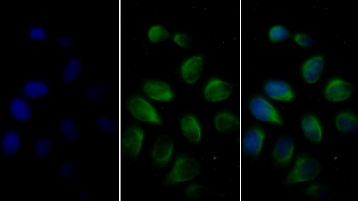 Monoclonal Antibody to Vimentin (VIM)