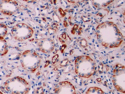 Monoclonal Antibody to Vimentin (VIM)