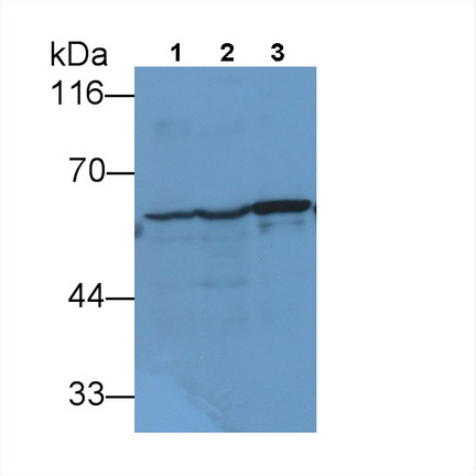 Monoclonal Antibody to Vimentin (VIM)