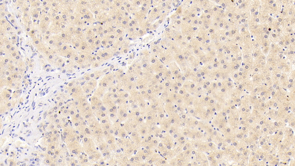 Monoclonal Antibody to Integrin Beta 1 (ITGb1)