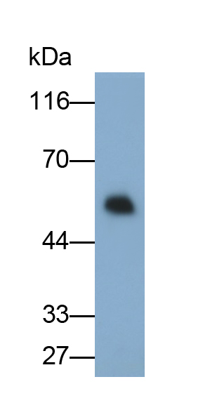 Monoclonal Antibody to Tumor Necrosis Factor Receptor Superfamily, Member 7 (TNFRSF7)