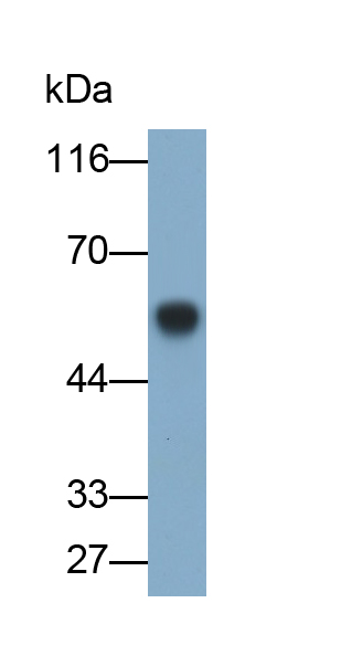 Monoclonal Antibody to Tumor Necrosis Factor Receptor Superfamily, Member 7 (TNFRSF7)