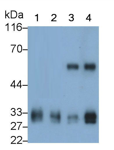 Monoclonal Antibody to Tryptase (TPS)