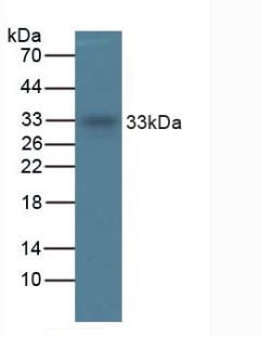 Monoclonal Antibody to Tryptase (TPS)