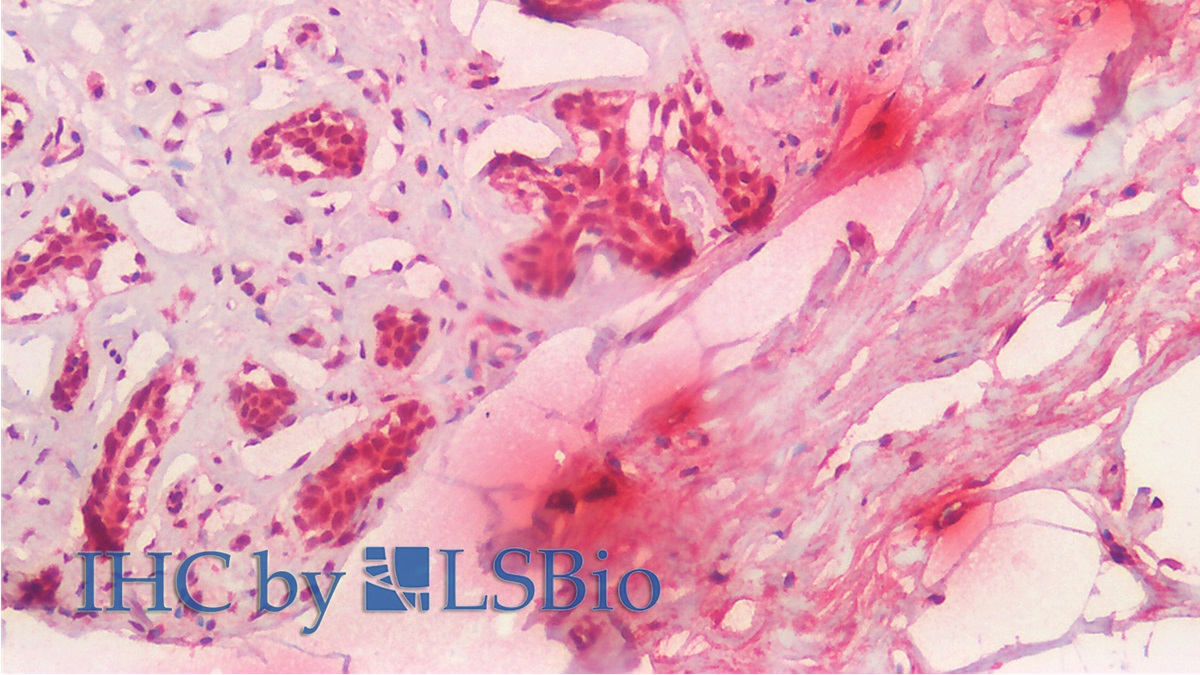 Monoclonal Antibody to Tryptase (TPS)