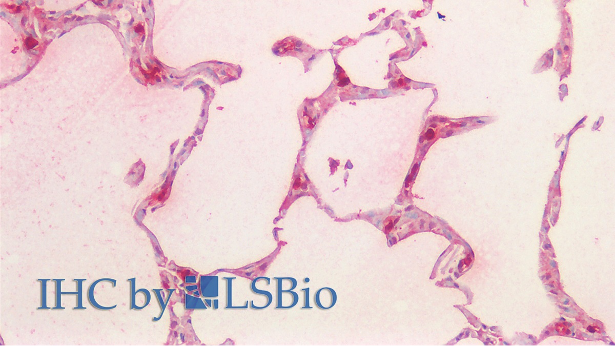 Monoclonal Antibody to Tryptase (TPS)