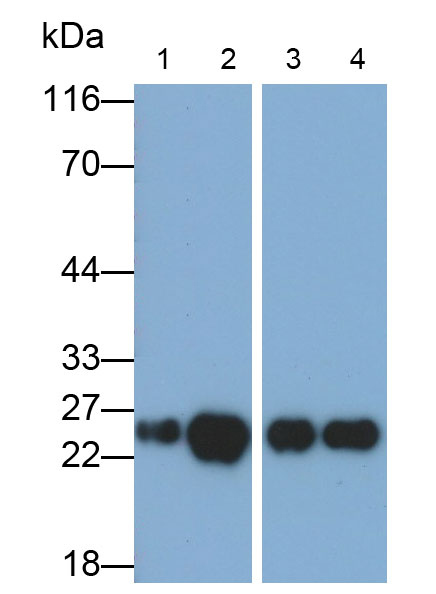 Monoclonal Antibody to Glutathione S Transferase Pi (GSTp)