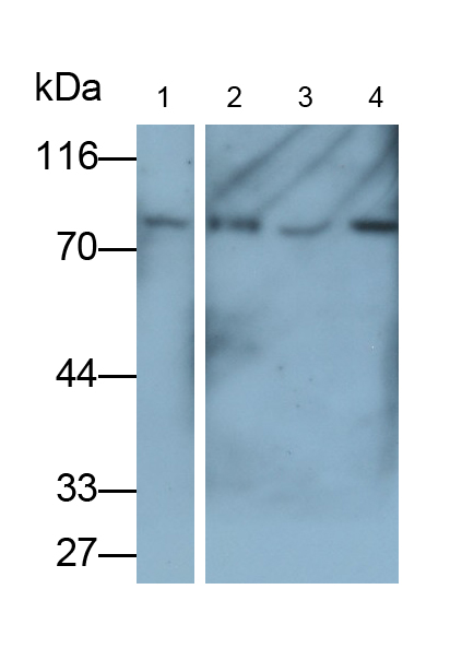Monoclonal Antibody to Alkaline Phosphatase, Tissue-nonspecific (ALPL)